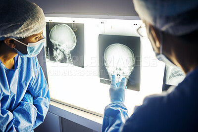 Buy stock photo Skull x ray, screen and doctor with analysis of scan, healthcare and surgery with medical team and neurology. Radiology, assessment and plan with people in hospital, surgeon and medicine with anatomy
