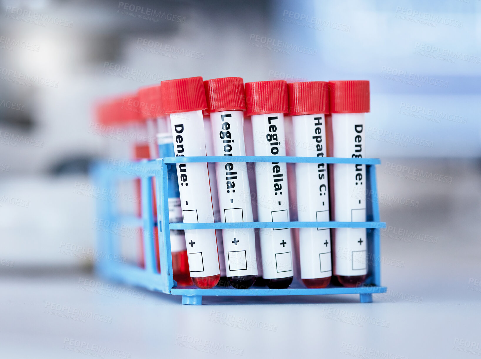Buy stock photo Blood in test tube, health and sample for experiment with medical research in lab. Science, healthcare and check DNA for virus or bacteria, scientific study and pathology, investigation and biotech