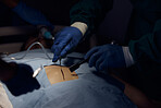 Surgeon hands, person and surgery operation, emergency service or help patient in dark room. Healthcare tools, operating theatre and closeup doctors doing medical procedure on client anatomy at night