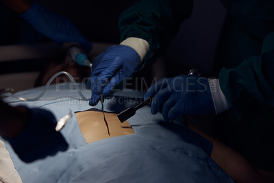 Buy stock photo Surgeon hands, person and surgery operation, emergency service or help patient in dark room. Healthcare tools, operating theatre and closeup doctors doing medical procedure on client anatomy at night