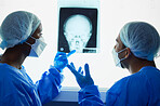 Head xray, doctors and medical discussion for planning test results, charts and advice for expert analysis. Radiology, neurology and surgeon team check skull x ray, anatomy and review mri for surgery