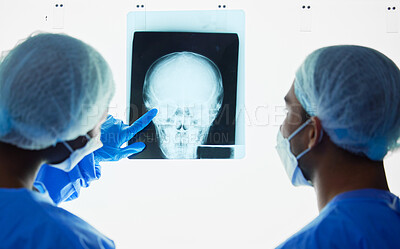 Buy stock photo Head xray, doctors and healthcare team planning test results, charts and advice for medical analysis. Radiology, neurology and surgeons check skull x ray, anatomy and review mri for hospital surgery 