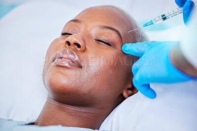 Buy stock photo Plastic surgery, injection and black woman on a hospital bed with dermatology with mockup space. Surgeon, facial change and medical filler for skincare, syringe and wellness in a clinic with doctor