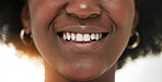 Dental, smile and teeth with closeup of person for medical, cosmetics and oral hygiene. Healthcare, orthodontics and beauty with mouth of black woman for self care, gum and whitening treatment