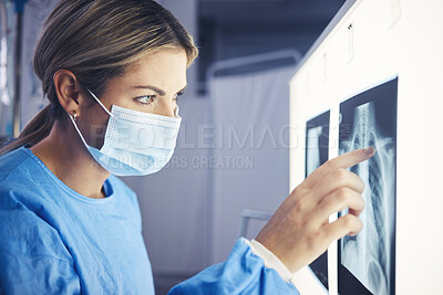 Buy stock photo Healthcare, woman and doctor analyzing xray for medical diagnosis on a screen in the hospital. Professional, career and female radiologist checking a spine, lung and chest scan in a medicare clinic.