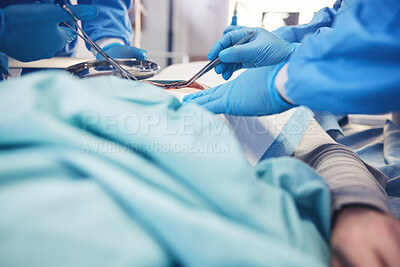 Buy stock photo Surgery, group hands and patient operation, hospital emergency service or doctors teamwork on wound healing. Accident operating room, medical tools and closeup surgeon collaboration on saving client