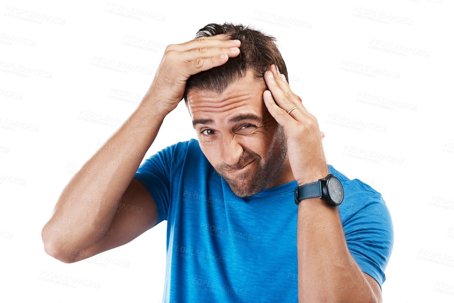 Buy stock photo Isolated man, check head and hair loss in portrait with stress, anxiety or psoriasis by transparent png background. Guy, male pattern baldness and inspection for cosmetic, alopecia and scalp health