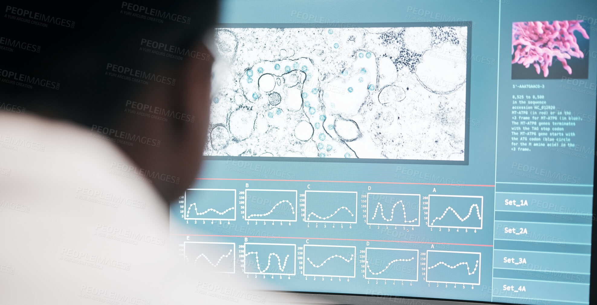 Buy stock photo Computer screen, medical and research with scientist, bacteria and data analysis with experiment results. Person, researcher or pc with particles, laboratory equipment and monitor with cells or virus