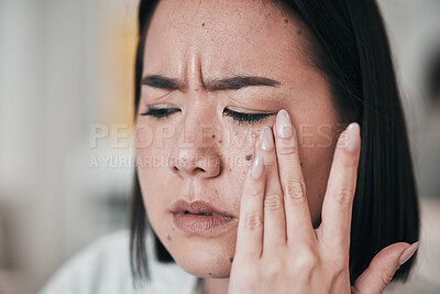 Buy stock photo Woman, scientist and headache from stress, anxiety or problem in laboratory working with pharmaceutical research. Tired, fatigue and professional burnout in science, lab or person with migraine pain