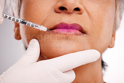 Buy stock photo Mouth needle, plastic surgery hands and woman with closeup surgeon augmentation, lip filler or silicone treatment. Studio spa clinic, collagen injection and client transformation on white background