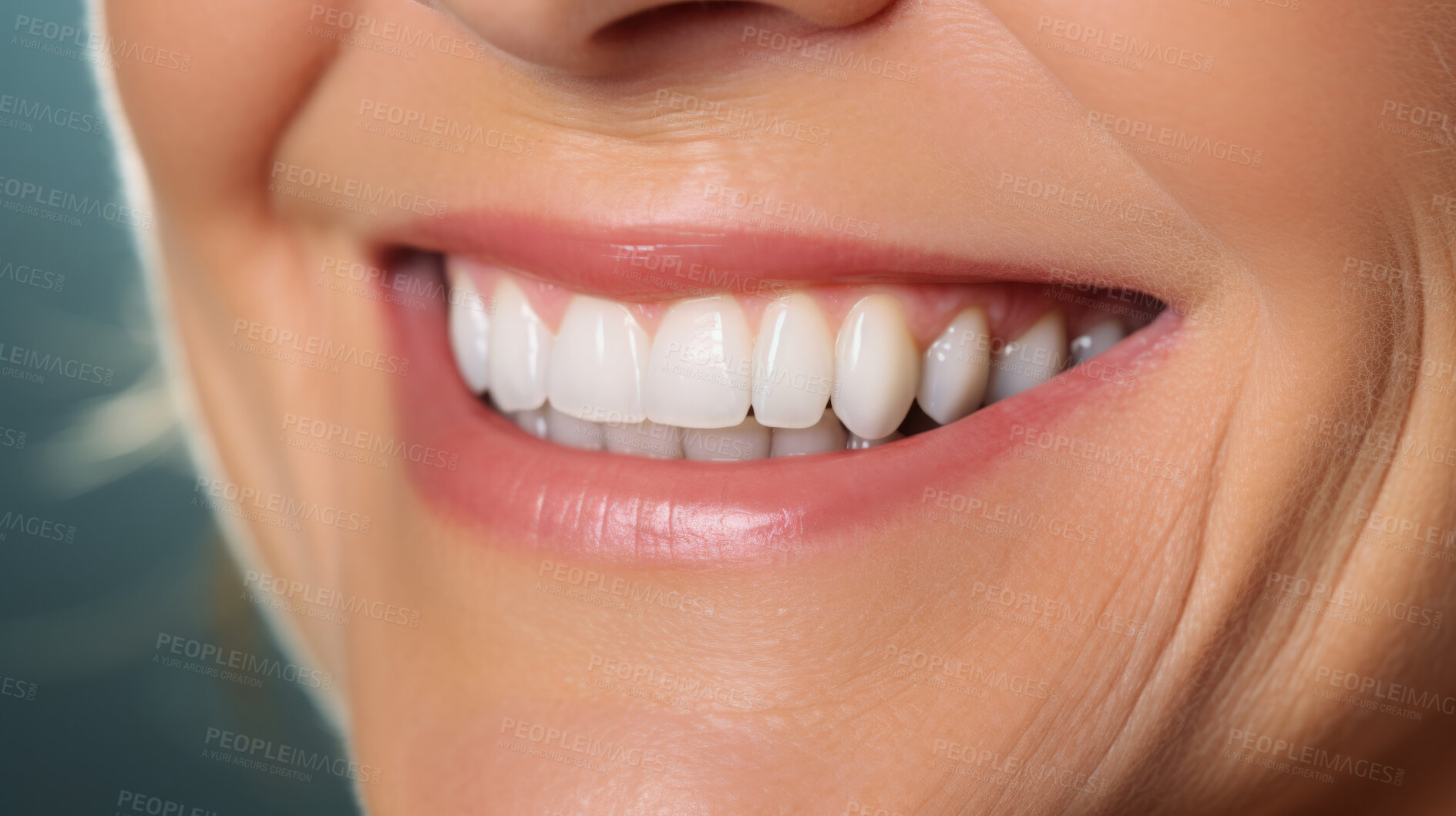 Buy stock photo Closeup of smile with white teeth. Dental care, teeth whitening procedure at dentist.
