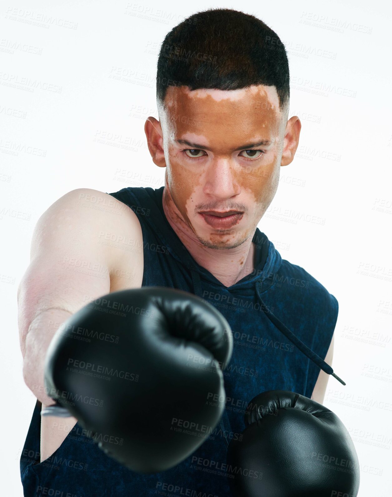 Buy stock photo Portrait shot of a handsome young male boxer with vitiligo posing in studio