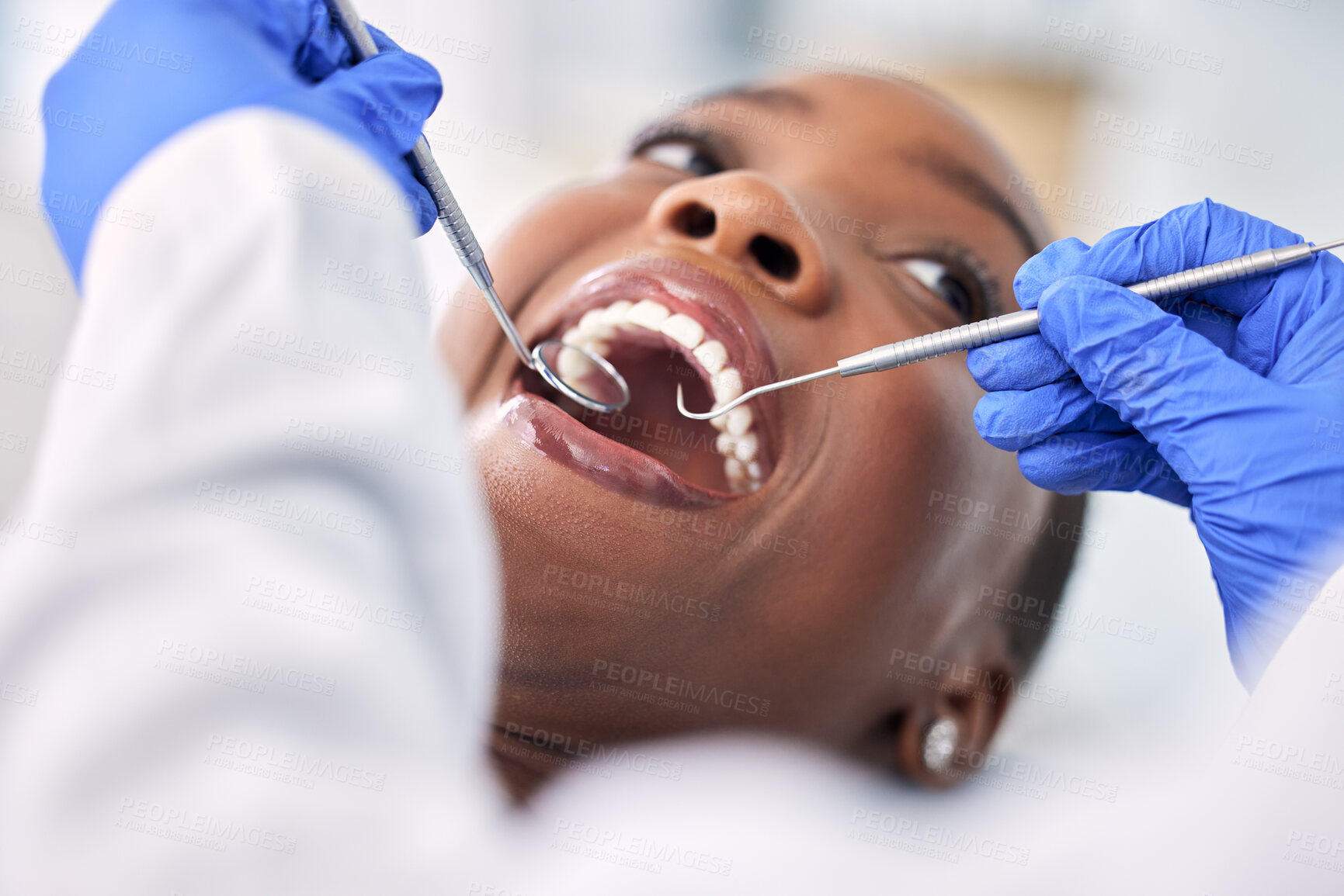 Buy stock photo Dentist, patient and women in consultation, tools and check mouth for dental health and medical treatment. Oral hygiene, healthcare and orthodontics, tooth decay and clean for cavity and excavator