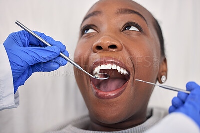 Dentist hands, patient mouth and tools, check teeth for dental health and medical treatment. Oral hygiene, healthcare and orthodontics, black woman with tooth decay and clean for cavity and excavator