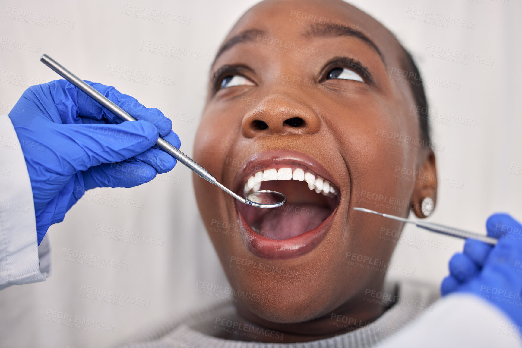 Buy stock photo Dentist hands, patient mouth and tools, check teeth for dental health and medical treatment. Oral hygiene, healthcare and orthodontics, black woman with tooth decay and clean for cavity and excavator