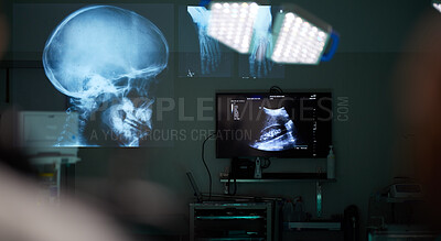 Buy stock photo Surgery room, xray and skull with healthcare, neuroscience and medicare with diagnosis. Holographic, medical treatment and skeleton with monitor, digital and brain with research, scan and anatomy