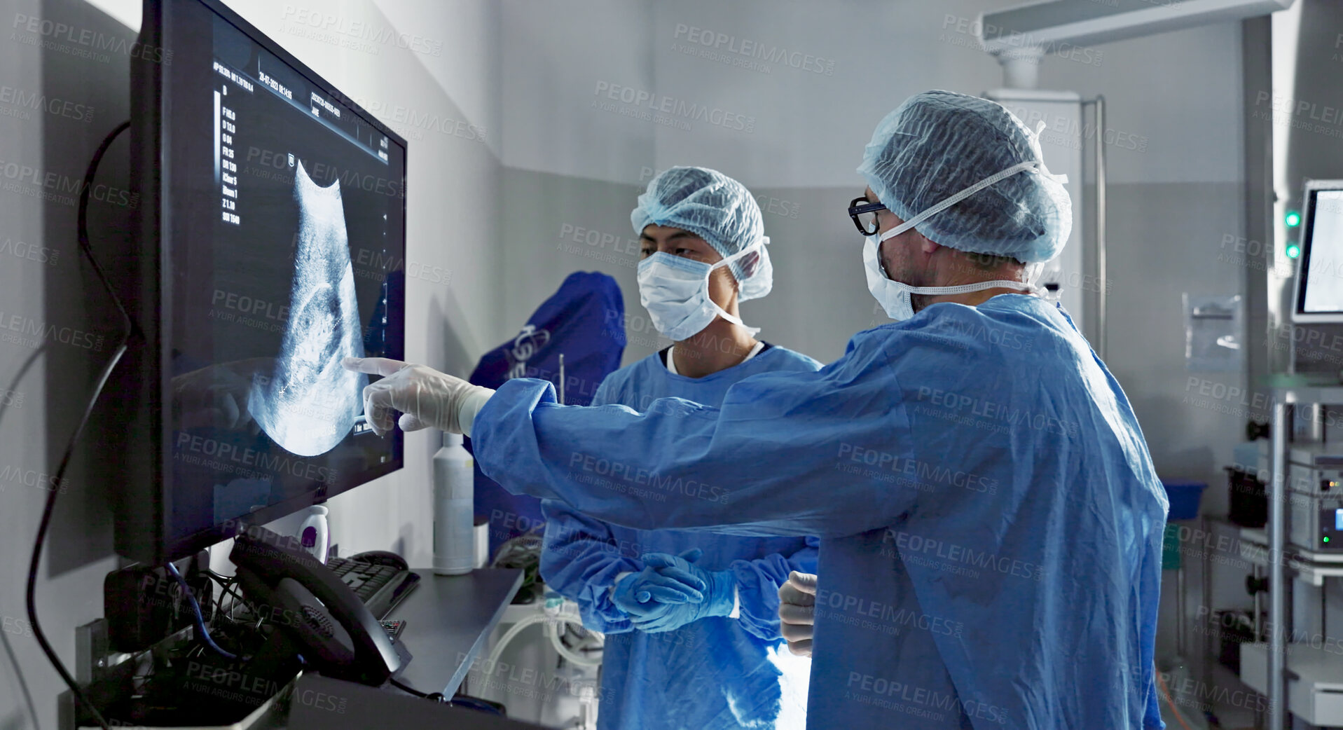 Buy stock photo Surgery, x ray and a team of doctors in the hospital for an operation or procedure to remove a tumor. Healthcare, medical teamwork and a surgeon looking at a screen with a medicine professional