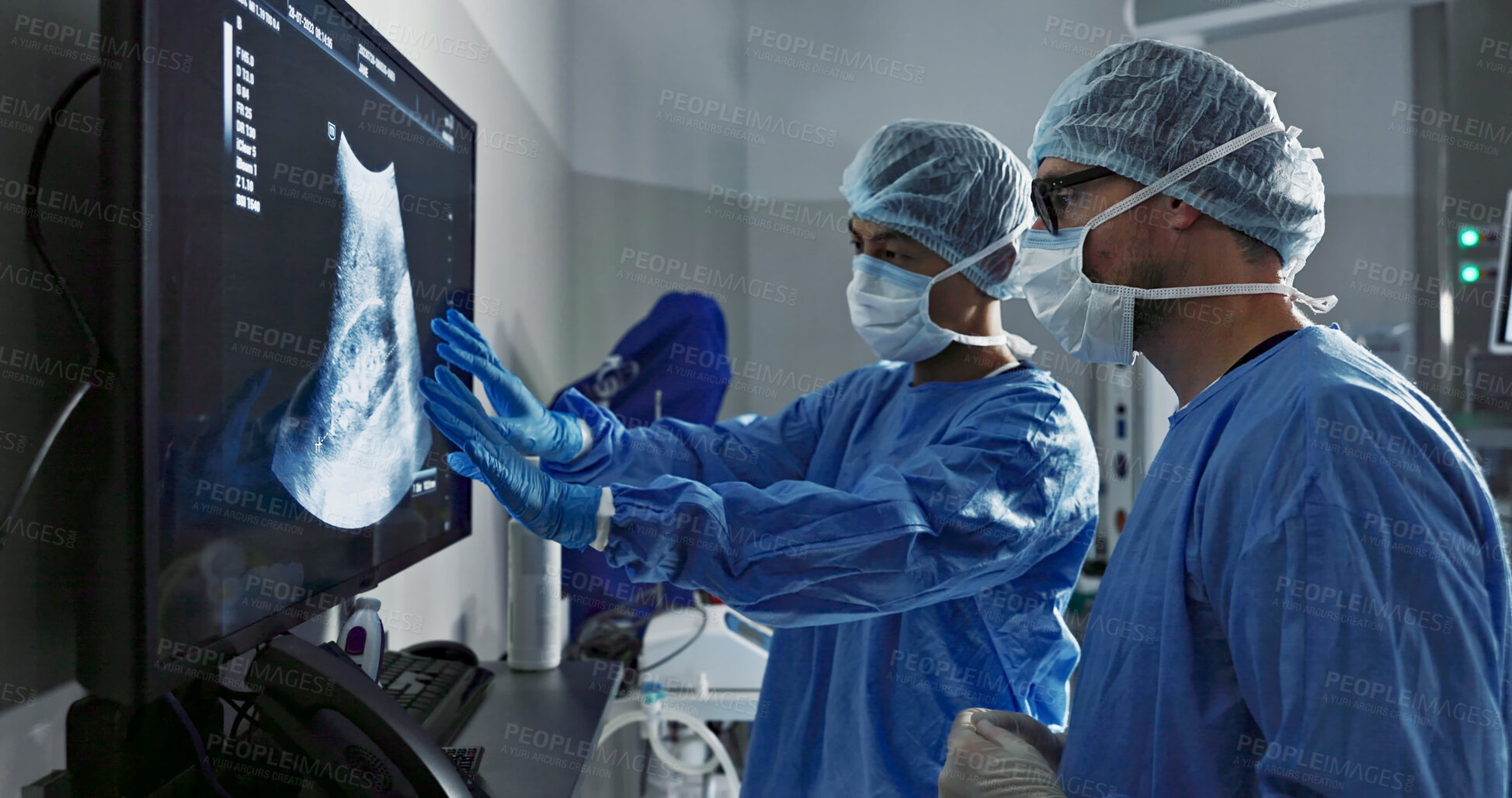 Buy stock photo Surgery, x ray and a team of doctors in the hospital for an operation or procedure to remove a tumor. Healthcare, medical teamwork and a surgeon looking at a screen with a medicine professional