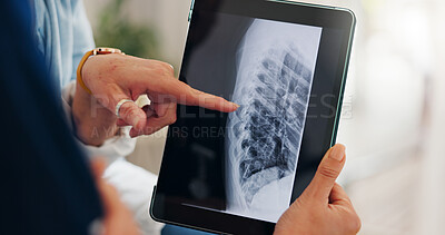 Buy stock photo Tablet in hands, lung xray and healthcare, analysis and radiology with doctor and patient at hospital. People with technology, health and surgery, cardiology and anatomy with assessment of scan
