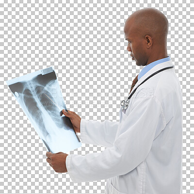 Buy stock photo Xray scan, doctor or black man check lung cancer risk, clinic research or MRI for medical investigation. X ray, anatomy assessment results or radiology surgeon isolated on transparent, png background