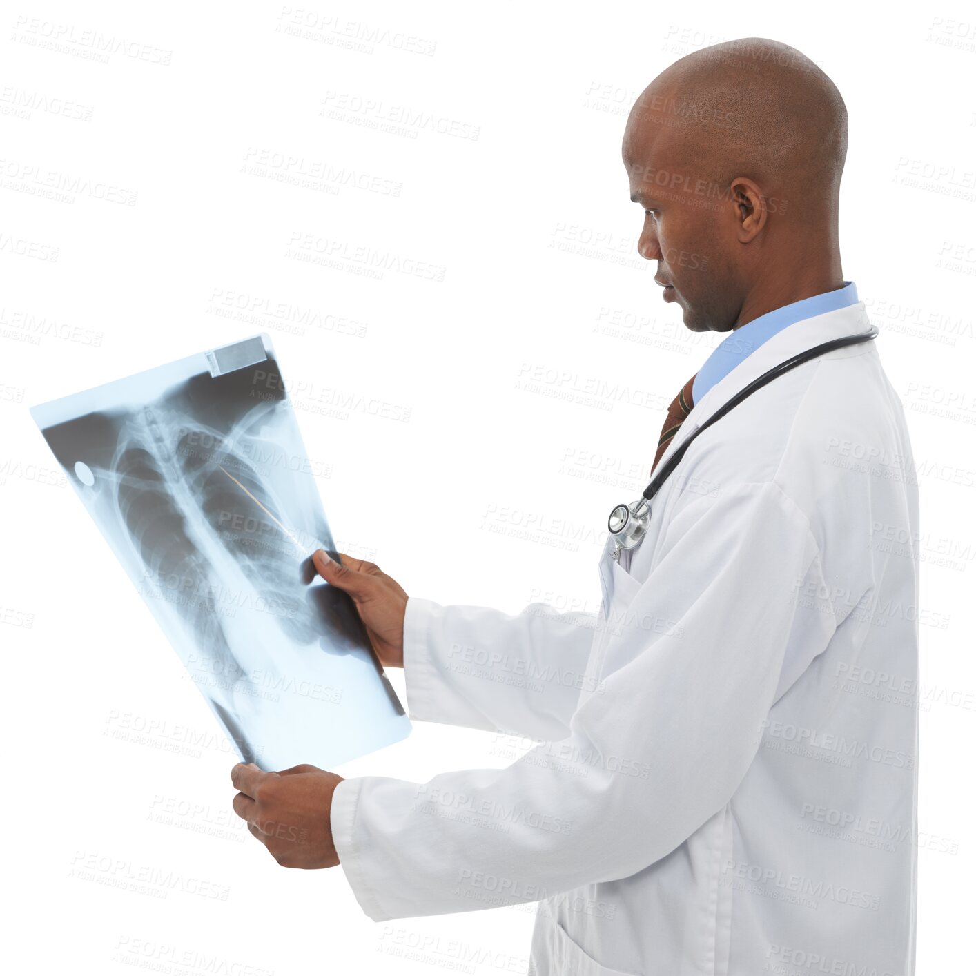 Buy stock photo Xray scan, doctor or black man check lung cancer risk, clinic research or MRI for medical investigation. X ray, anatomy assessment results or radiology surgeon isolated on transparent, png background