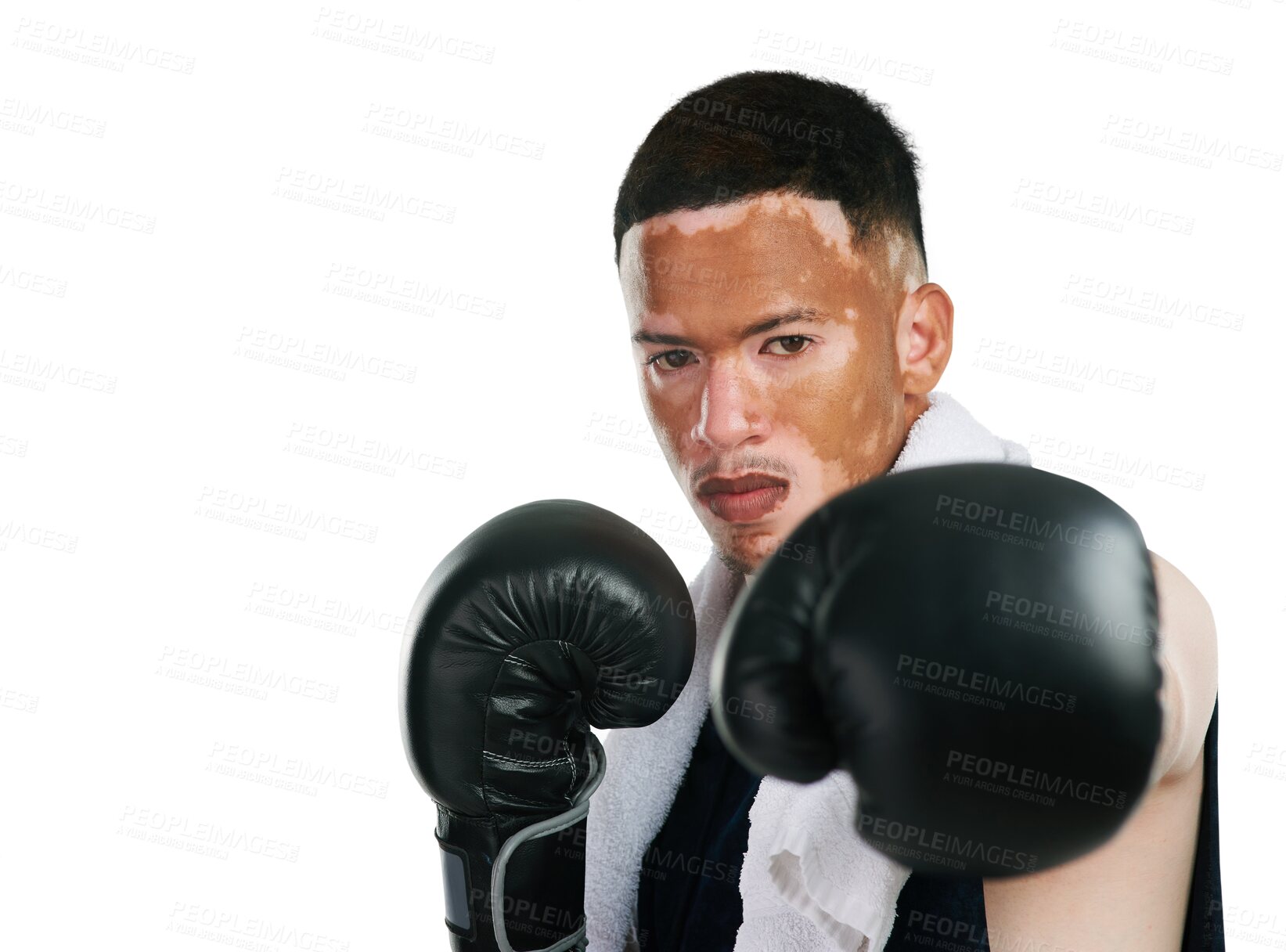 Buy stock photo Man with vitiligo and portrait and boxing gloves for fight, self defense or training isolated on transparent PNG background. Face of person, boxer or fighter with skin pigmentation in sports fitness