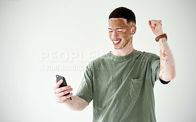 Buy stock photo Studio shot of a young man with vitiligo cheering while using a cellphone against a white background