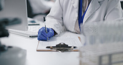 Hand, laboratory and checklist on clipboard or healthcare research for breakthrough, science or innovation. Person, fingers and pen at desk for vaccine investigation or project results, cure or form