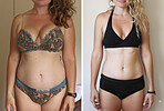 Collage, woman and body for before after weightloss at home with diet, liposuction or Ozempic treatment. Comparison, transition or makeover of female person with medicine, cosmetics or routine