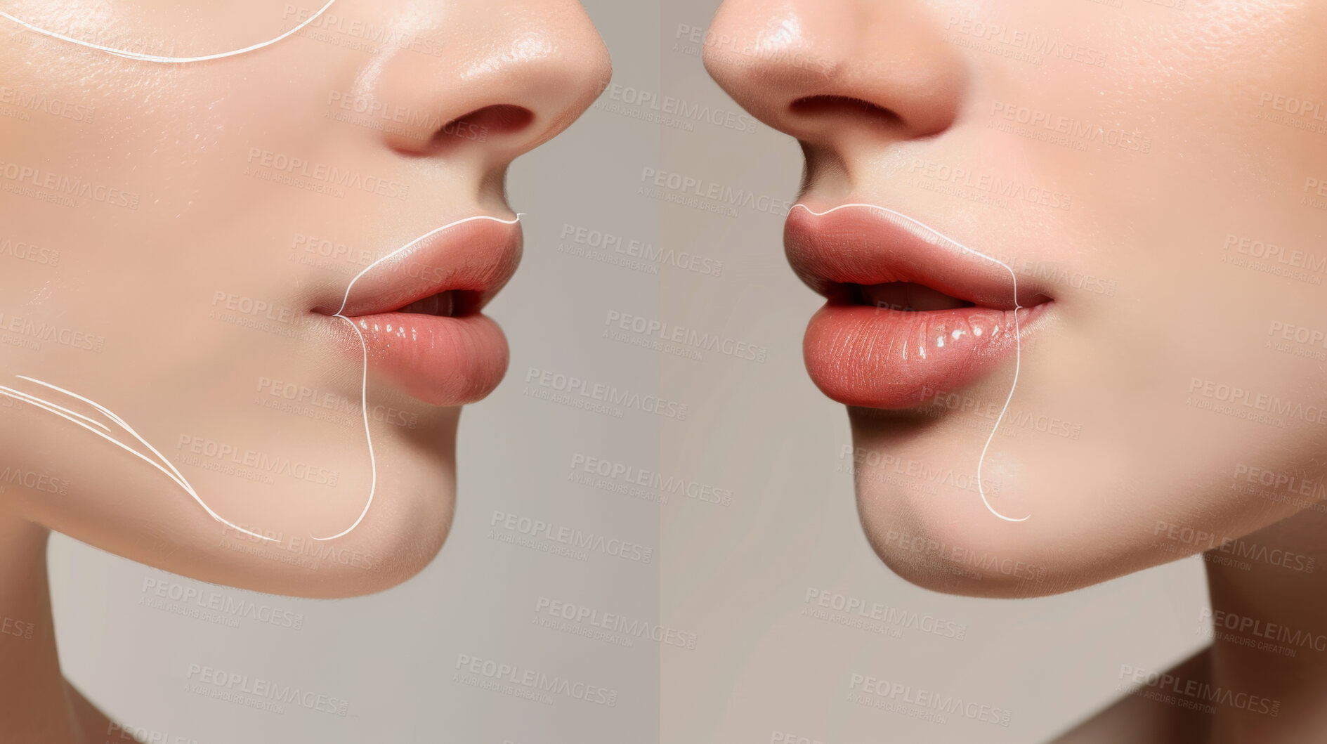 Buy stock photo Before after, woman and surgery with lips for facial with makeover in studio with lip filler injections. Beauty, care and closeup with cosmetics for botox with augmentation from expert in clinic