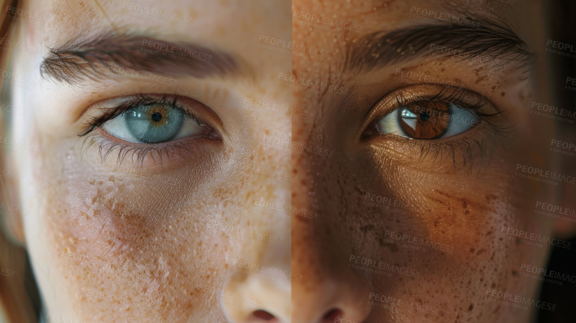 Buy stock photo Closeup, eyes and heterochromia with portrait, people and vision for optical care and optometry. Woman, skin and collage for dermatology treatment, skincare and chemical peel compare or uv radiation