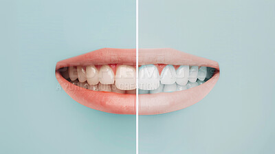 Teeth whitening, mouth and illustration with before and after for oral health, healthcare and enamel decay. Tooth bleaching, toothpaste and dental implants for health, hygiene and cleaning at dentist