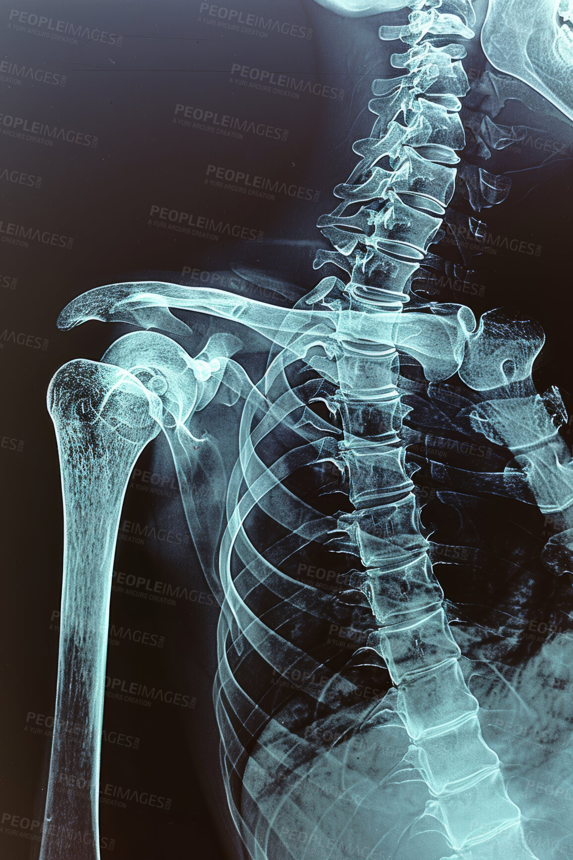 Buy stock photo Xray, anatomy and human skeleton on film, body injury and spine and vertebrae for radiology examination. Joints, electromagnetic radiation and bone image or internal structure, assessment and health