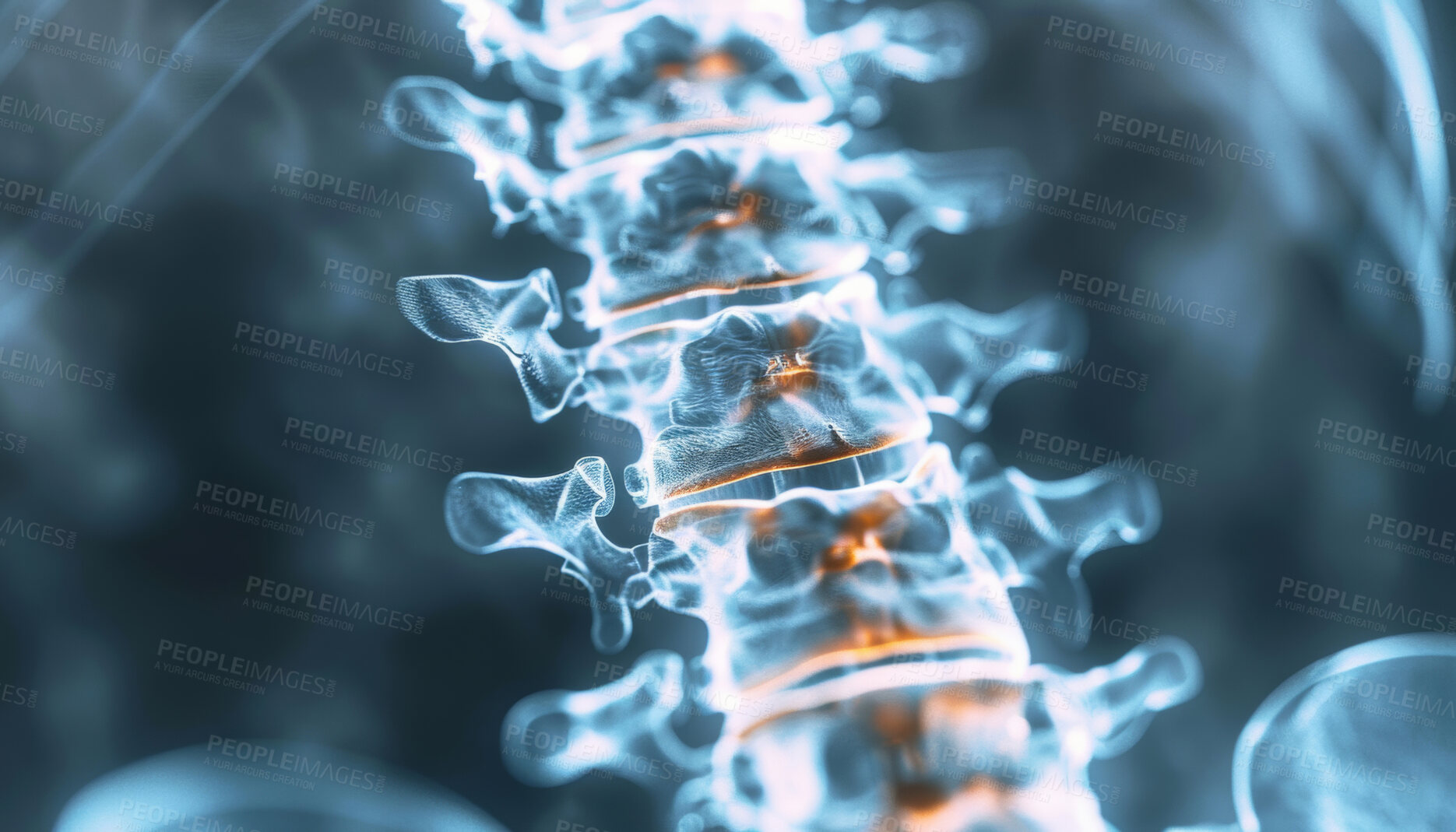 Buy stock photo Healthcare, anatomy and 3d xray of spine with inflammation for osteoporosis, infection or scoliosis. Medical, radiology and neuroscience with scan of skeleton for disease, evaluation and examination