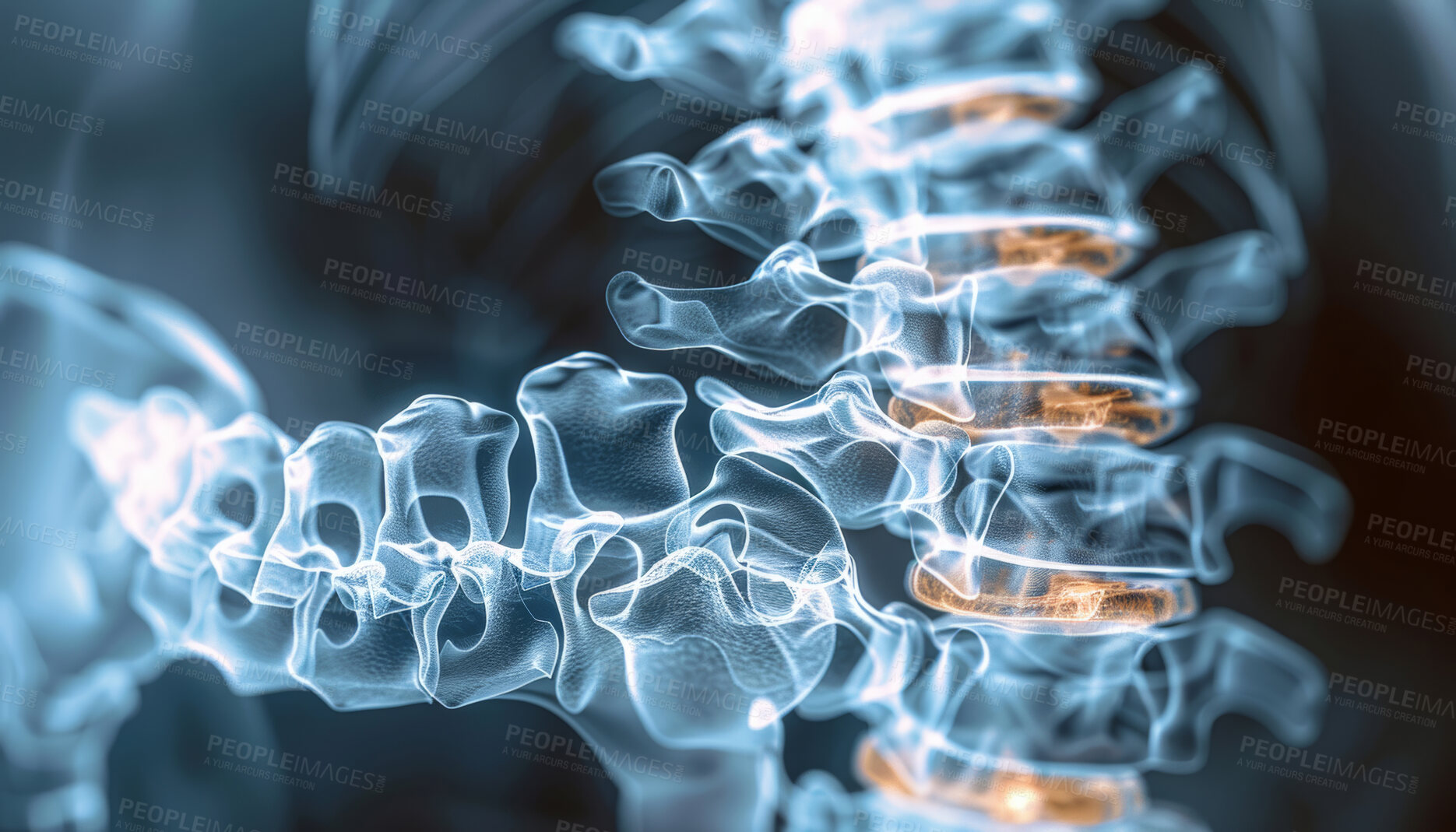 Buy stock photo Healthcare, anatomy and 3d scan of spine with inflammation for scoliosis, infection and evaluation. Medical, neuroscience and radiology with xray of skeleton for osteoporosis, disease and examination