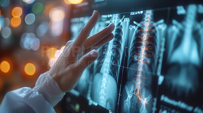 Person, hands and medical xray of lungs with fluid, tuberculosis or cancer for research with anatomy hologram. Doctor, finger and futuristic medicare with analytic dashboard for planning surgery