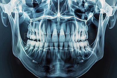 Medical, scan and illustration of teeth in mouth for healthy growth, evaluation or examination. Dental, radiology and skeleton in healthcare with 3d xray for investigation, oral surgery or assessment