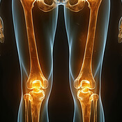Human legs, xray and bone on black background with glow of knee and ...