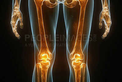 Human legs, xray and bone on black background with glow of knee and exam or 3D anatomy in healthcare. Futuristic infographic illustration for medical research, learning and education of arthroplasty