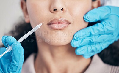 Buy stock photo Woman, injection and lip surgery with filler for transformation, cosmetics and doctor hand with needle. Plumping, professional and makeover with surgeon, patient and dermatology in clinic for beauty.