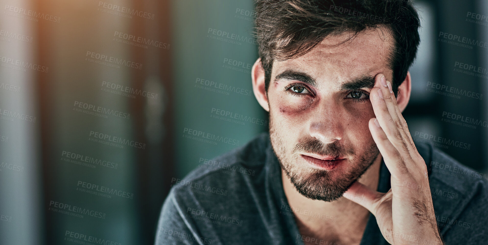 Buy stock photo Domestic violence, bruise and face of man in house with depression, fear or anxiety for fighting, conflict or attack trauma. Home, wound and victim with injury from abuse, disaster or horror ptsd