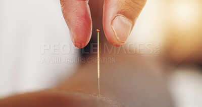 Buy stock photo Acupuncture, needles and skin with hand in closeup, alternative medicine or healing therapy. Relax, muscle and body pain in clinic for health or wellness, support for immune system or stress injury