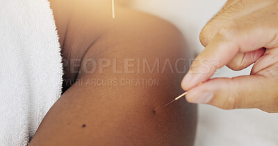 Buy stock photo Acupuncture, needles and skin for wellness in clinic, alternative medicine or healing therapy. Relax, muscle and person in spa for health or stress treatment, support for immune system or injury