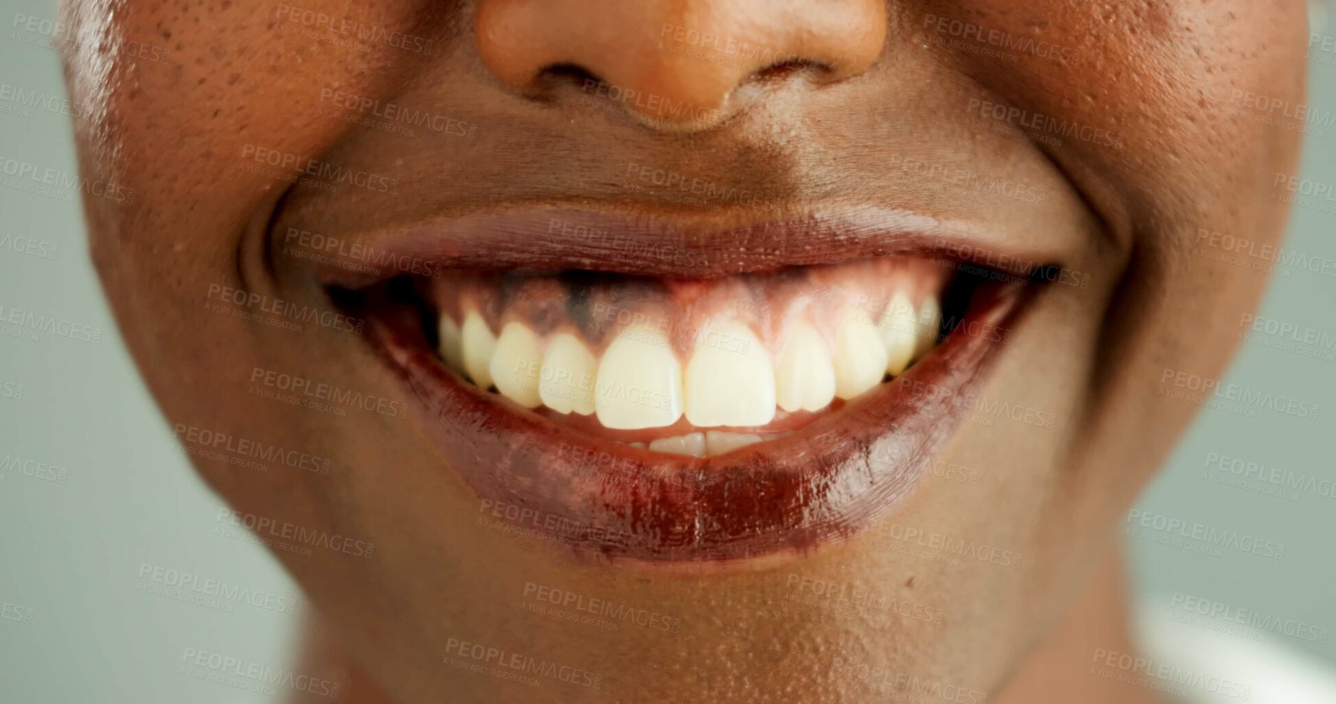 Buy stock photo Person, african and closeup with teeth, smile and dental care and oral hygiene or health. Mouth, zoom and portrait with wellness, medical and happy with dentist results and whitening for beauty