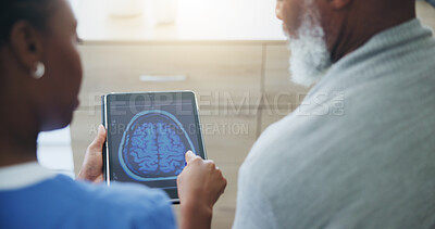 Buy stock photo Healthcare, tablet screen or brain scan by doctor with old man for medical, analysis or diagnosis. Neuro, digital radiography or neurologist and patient for Alzheimer, dementia or memory loss surgery