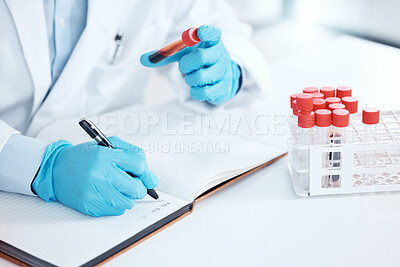 Buy stock photo Hands, writing and blood sample in laboratory for science, research and ppe for planning. Notebook, test tube and dna for wellness or healthcare with person and development or innovation in hospital 