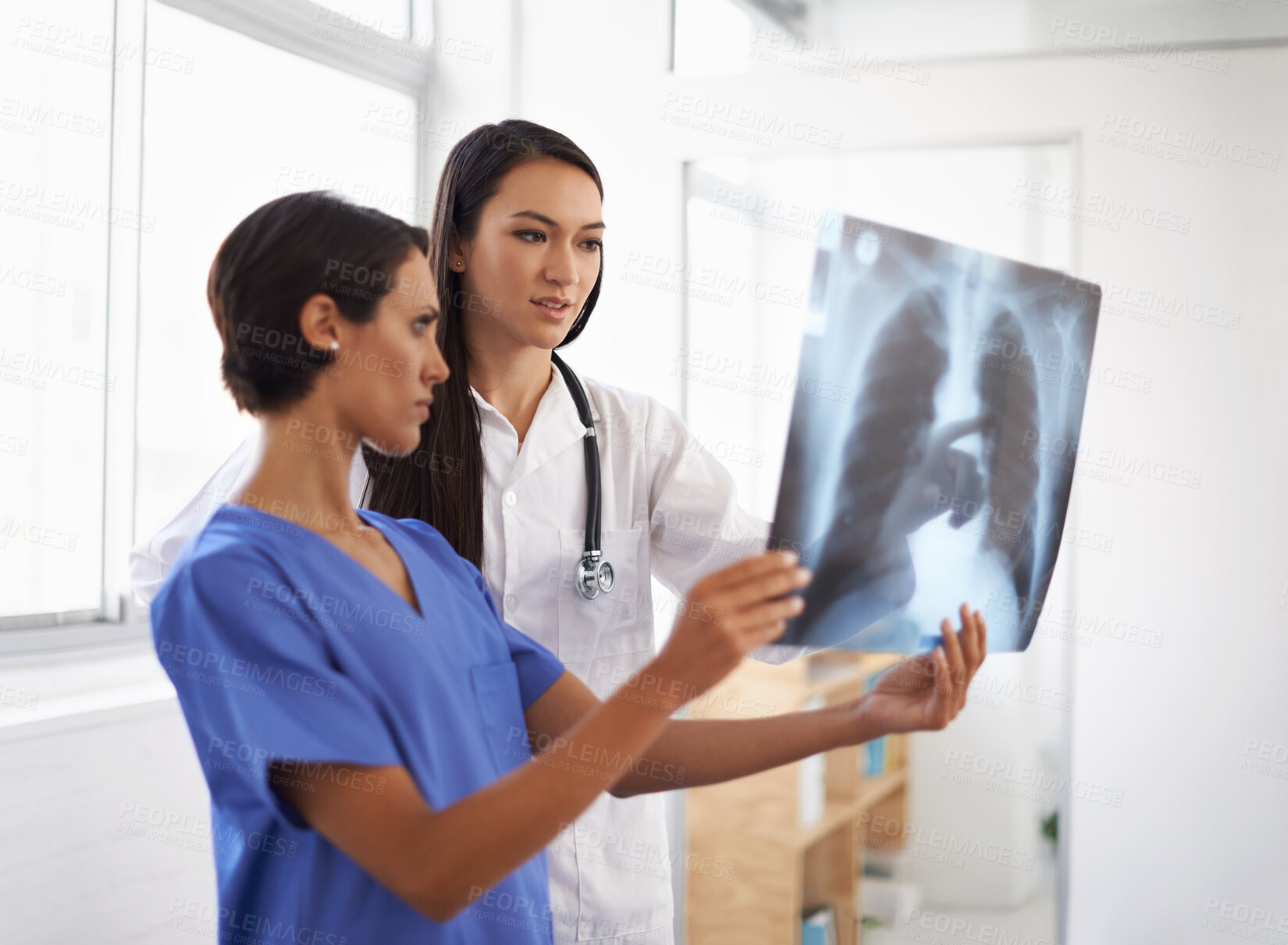 Buy stock photo X ray, doctor and nurse with results in hospital, medical facility or clinic for lung exam or radiology. Women, people and healthcare workers with document, research or analysis of respiratory system