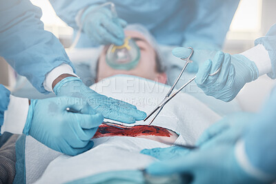 Buy stock photo Hands, blood and operation with a team of doctors at work during surgery with equipment or a tool in a hospital. Doctor, nurse and collaboration with a medicine professional group saving a life