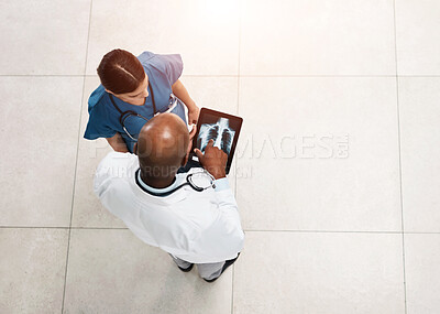 Buy stock photo Doctor, xray and hospital collaboration with tablet, lung scan results and medical diagnosis for surgery. Above, digital and healthcare people with tech and respiratory system check for cancer test