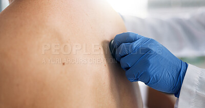 Buy stock photo Doctor, hand and stethoscope on back of patient in hospital for breathing or respiratory examination. Asthma, consulting or healthcare with medicine professional listening to lungs for medical test